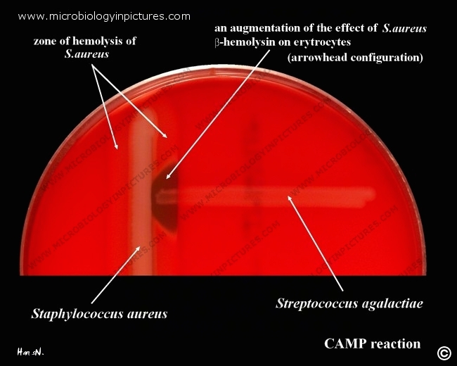 positive  CAMP test, positive CAMP reaction